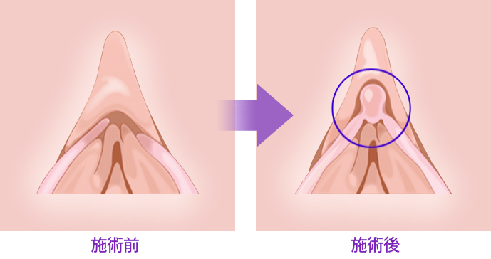 수술 전 / 수술 후 비교