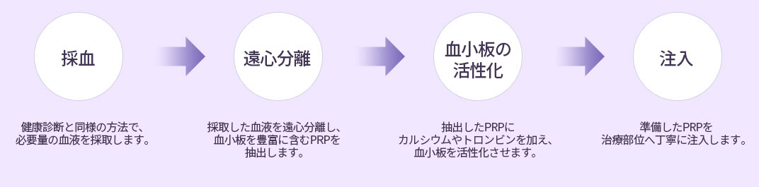 PRP 과정 — 채혈 → 원심분리 → 혈소판 활성화 → 피부주사